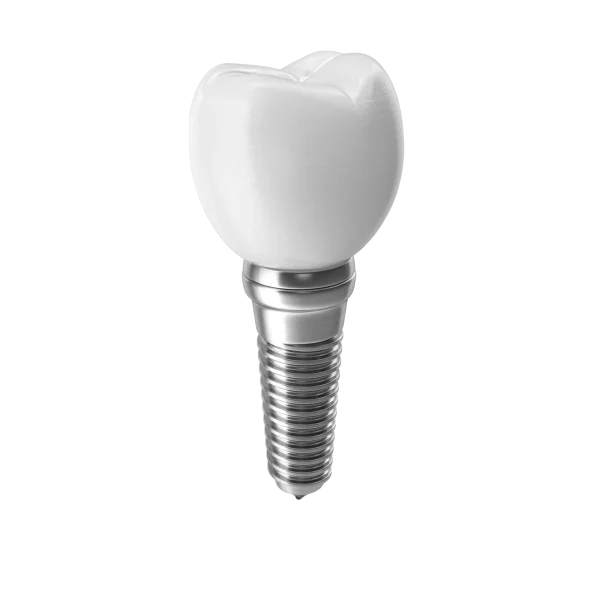close-up-dental-implant-with-artificial-tooth